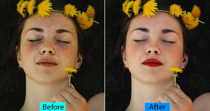 A before and after image of a Blemish Removal photo 